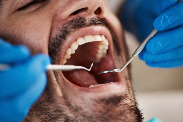 Best Mobile Emergency Dentist in Rotan, TX