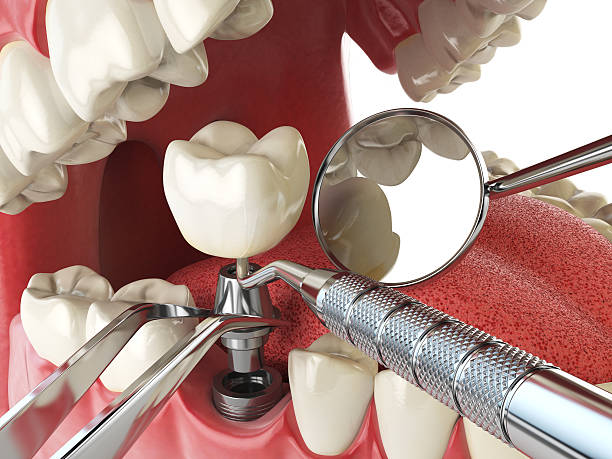 Best Orthodontic Emergency Dentist in Rotan, TX